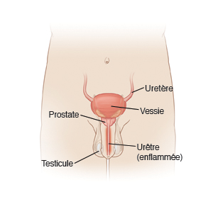 Uretère, vessie, prostate, urêtre (enflammée), testicule