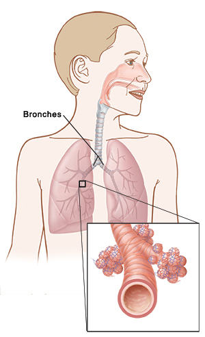 Bronches
