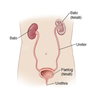 Ilustrasyon na nagpapakita ng balangkas ng katawan kasama ang mga organo na bahagi ng sistema ng pagihi, kabilang ang mga bato, ureter, pantog at uretra.