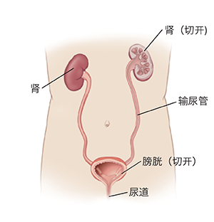 图示躯干及泌尿系统内器官的轮廓,包括肾、输尿管、膀胱和尿道