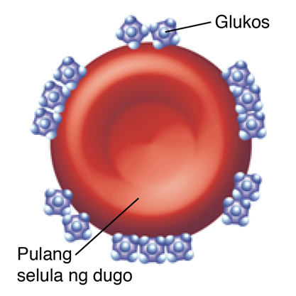 Pulang selula ng dugo na maraming nakadikit na molekula ng glukos.