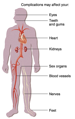 Outline of human figure showing heart, kidneys, blood vessels, and nerves. Complications of diabetes may affect eyes, teeth and gums, heart, kidneys, sex organs, blood vessels, nerves, and feet.