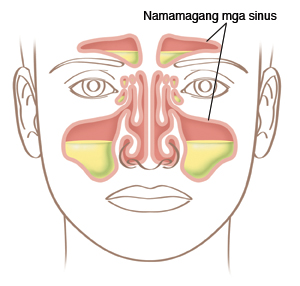 Ilustrasyon ng mukha na nagpapakita ng mga magang sinus.